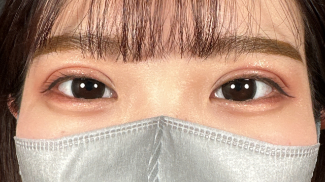 Postoperative Condition Part 1