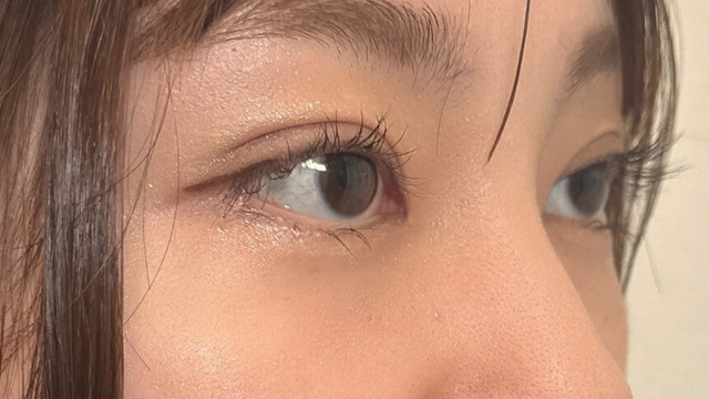 Postoperative Condition Part 1