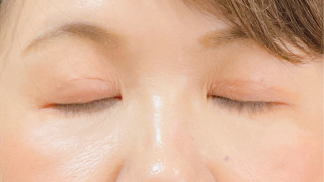 Postoperative Condition Part 1