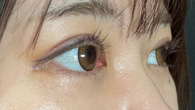 Postoperative Condition Part 1