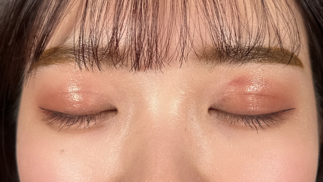 Postoperative Condition Part 1