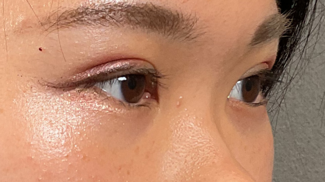 Postoperative Condition Part 1