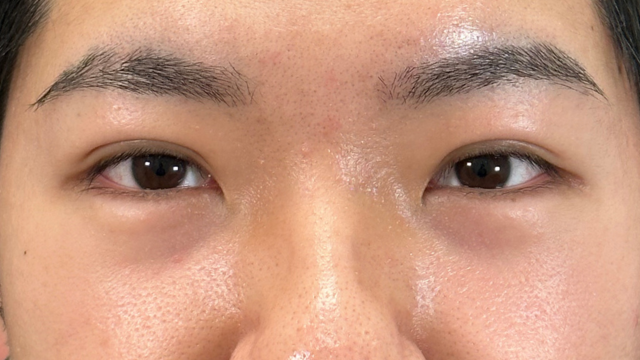 Postoperative Condition Part 1