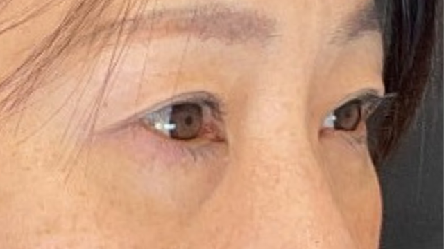 Postoperative Condition Part 1