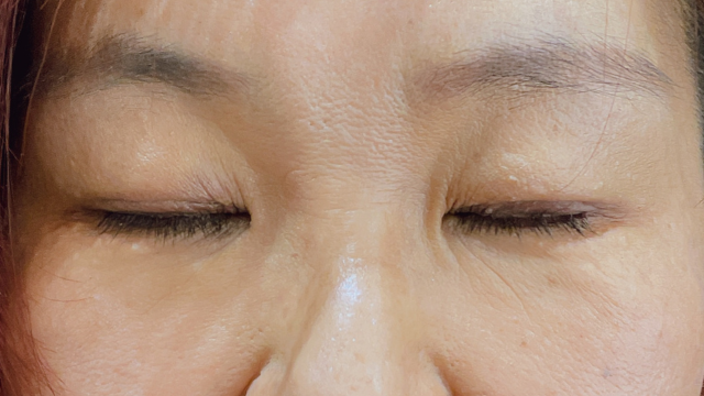 Postoperative Condition Part 1