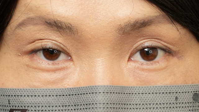 Postoperative Condition Part 1