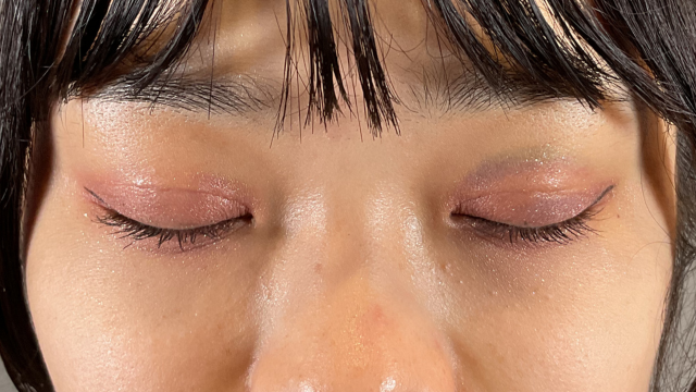 Postoperative Condition Part 1