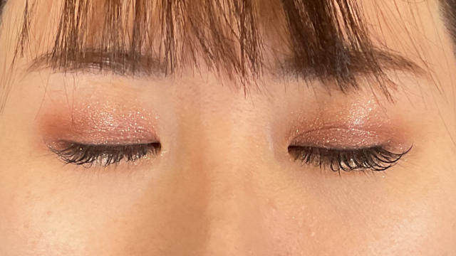 Postoperative Condition Part 1