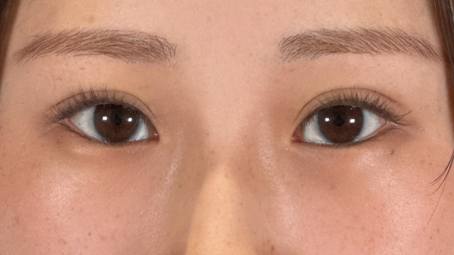 Postoperative Condition Part 1