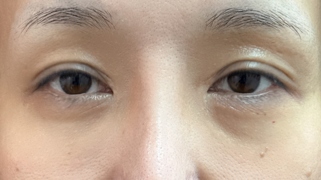 Postoperative Condition Part 1