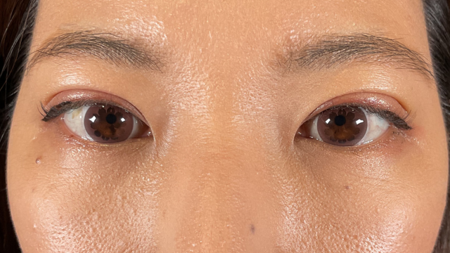 Postoperative Condition Part 1