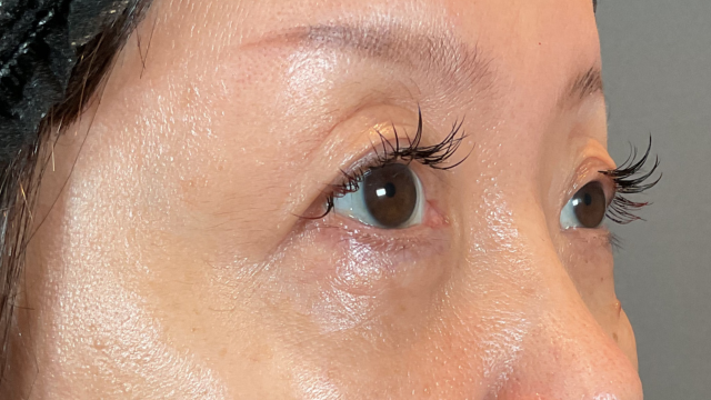 Postoperative Condition Part 1