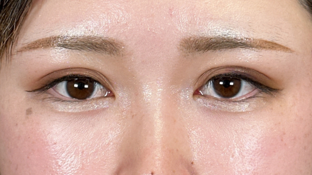 Postoperative Condition Part 1