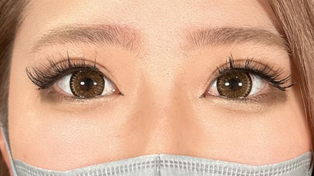 Postoperative Condition Part 1