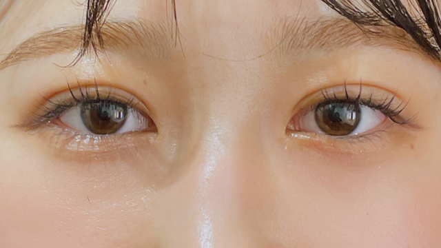 Postoperative Condition Part 1