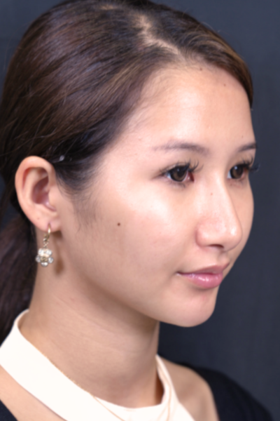 Postoperative Condition Part 1