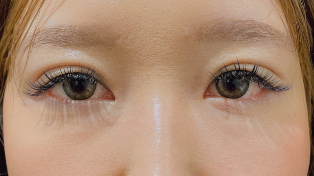 Postoperative Condition Part 1