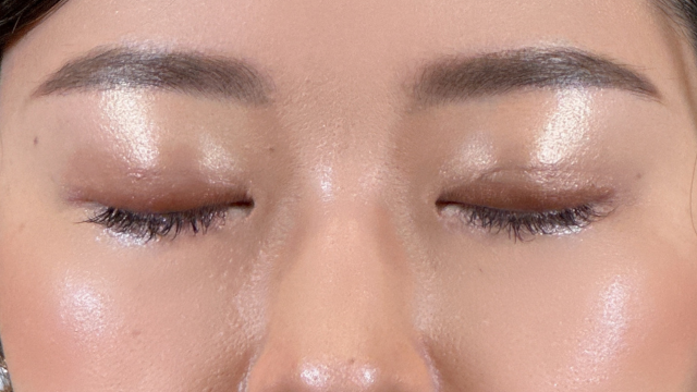 Postoperative Condition Part 1