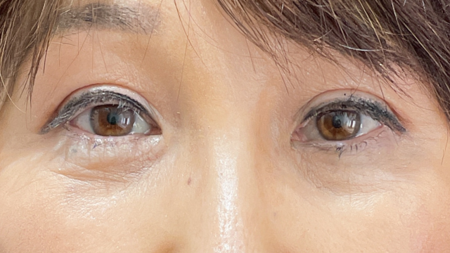 Postoperative Condition Part 1