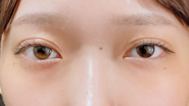 Postoperative Condition Part 1