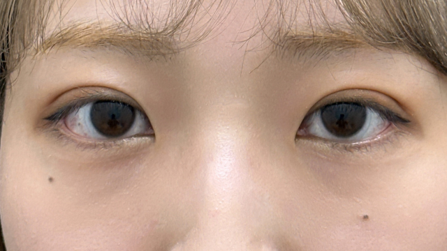 Postoperative Condition Part 1