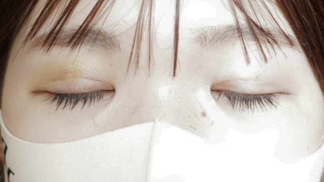 Postoperative Condition Part 1