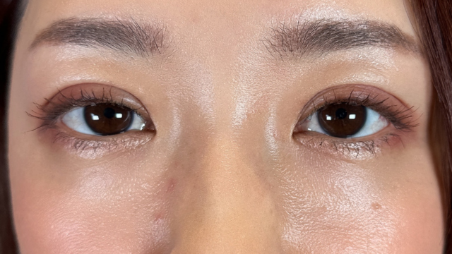 Postoperative Condition Part 1