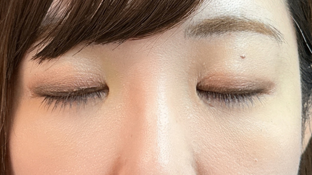 Postoperative Condition Part 1