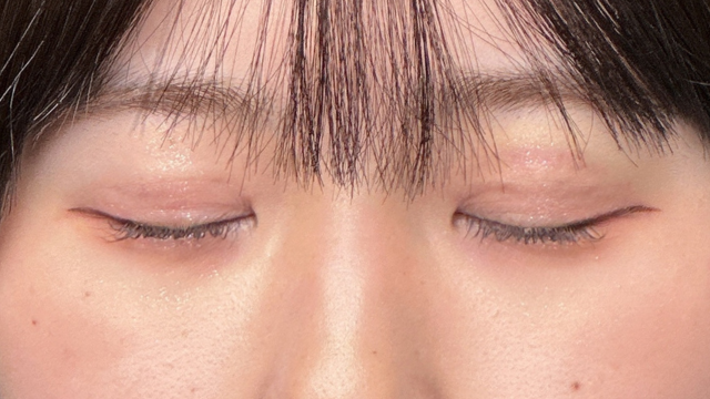 Postoperative Condition Part 1