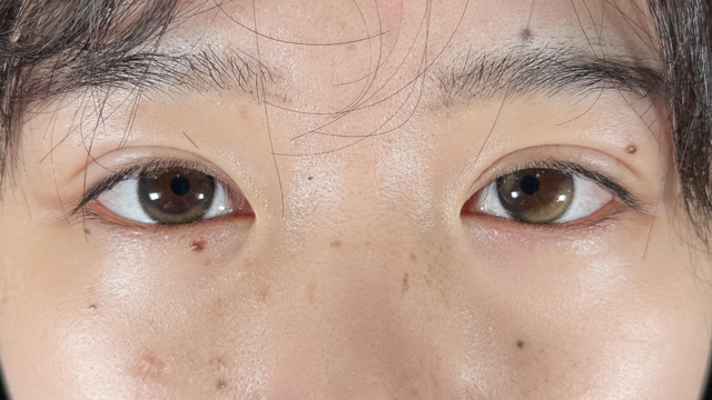 Postoperative Condition Part 1