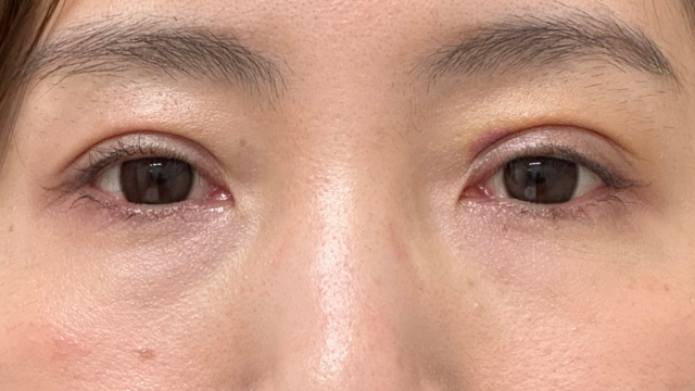 Postoperative Condition Part 1