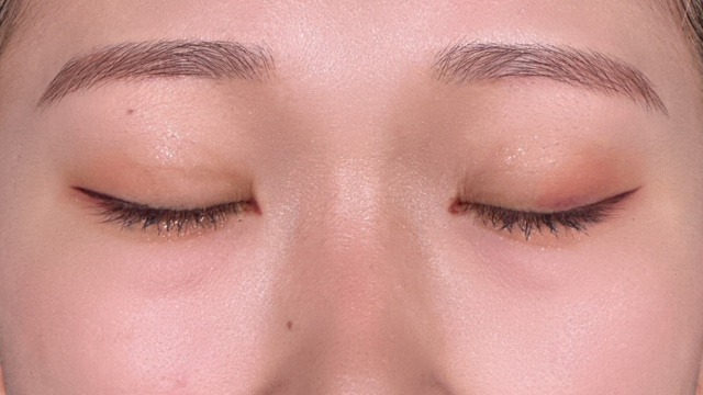 Postoperative Condition Part 1