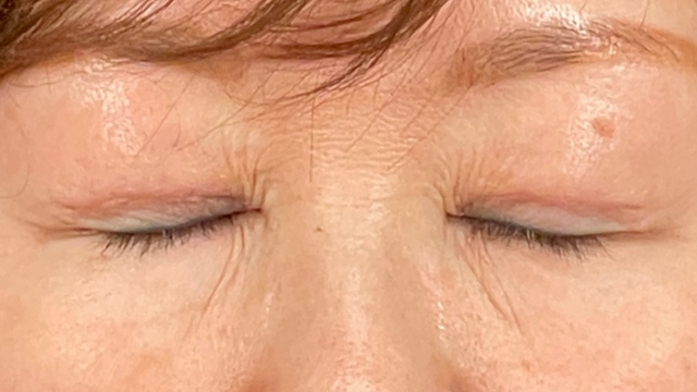 Postoperative Condition Part 1