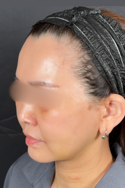 Postoperative Condition Part 1