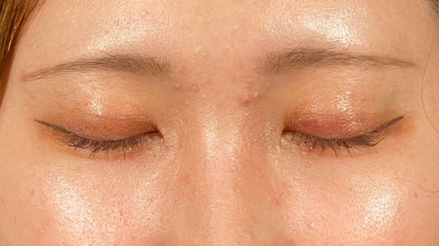 Postoperative Condition Part 1