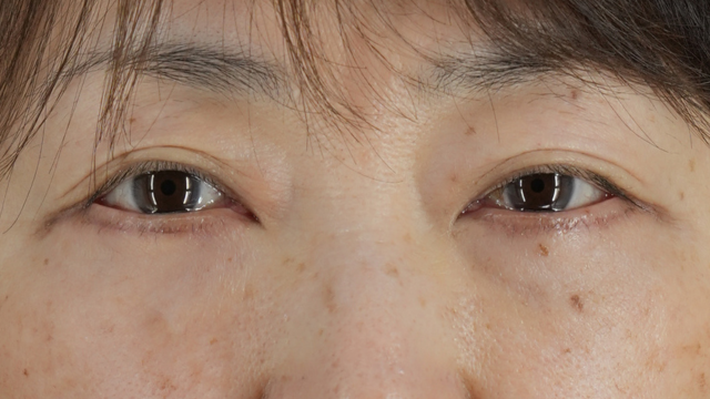 Postoperative Condition Part 1