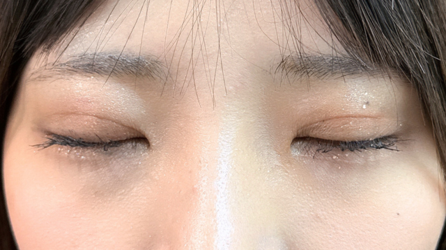 Postoperative Condition Part 1