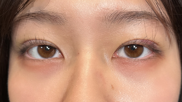 Postoperative Condition Part 1