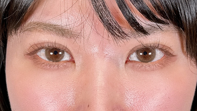 Postoperative Condition Part 1