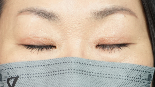 Postoperative Condition Part 1