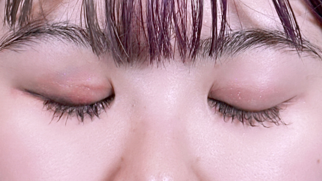 Postoperative Condition Part 1