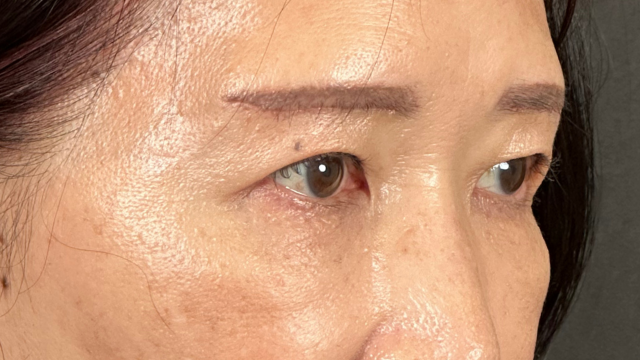 Postoperative Condition Part 1