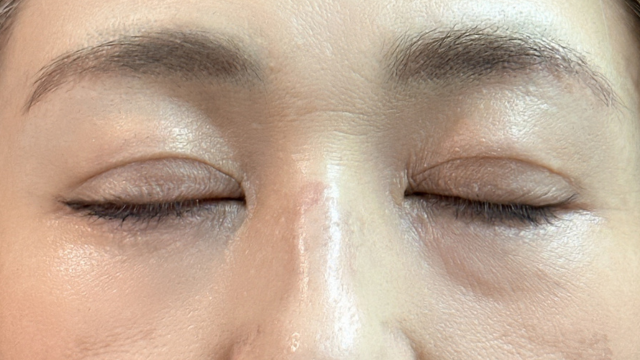 Postoperative Condition Part 1