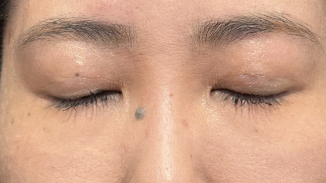 Postoperative Condition Part 1