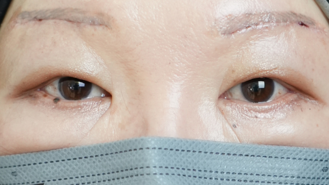 Postoperative Condition Part 1