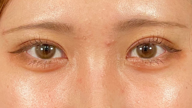 Postoperative Condition Part 1