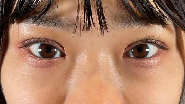 Postoperative Condition Part 1