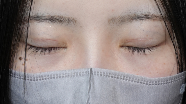 Postoperative Condition Part 1