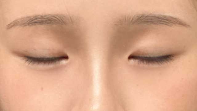 Postoperative Condition Part 1