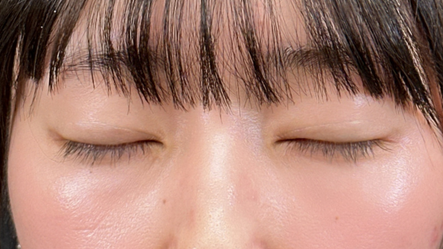 Postoperative Condition Part 1